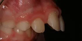 ag before