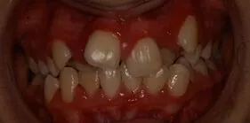 ld before