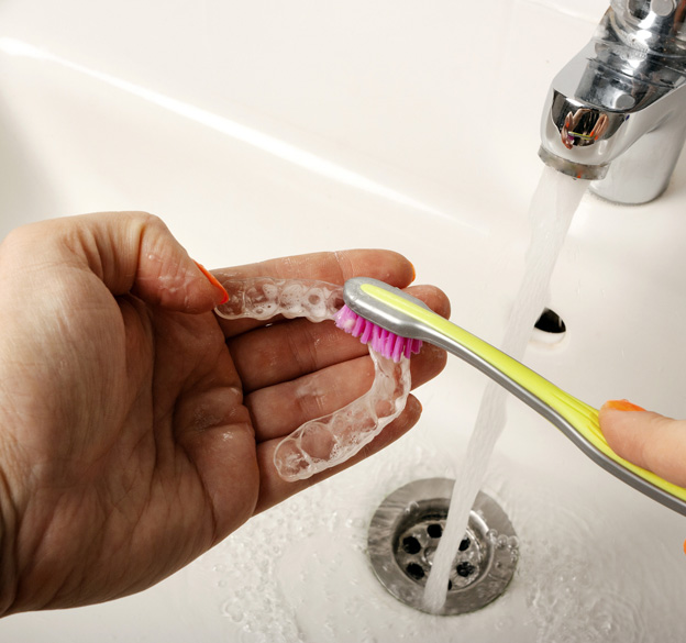 how to look after your retainers