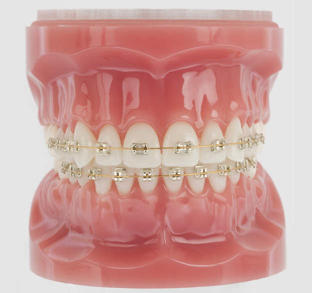 Iconix Champagne metal-coloured brackets