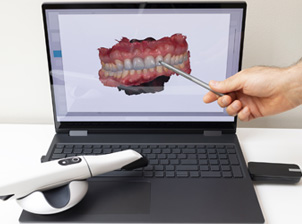 smile simulations